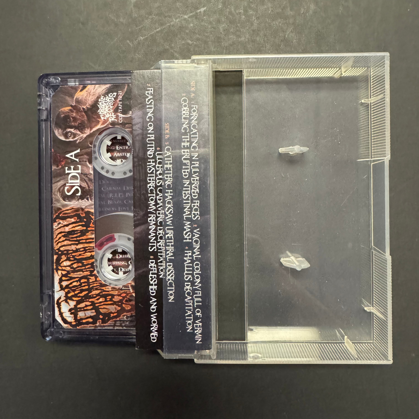 Epicardiectomy - Abhorrent Stench of Posthumous Gastrorectal Desecration cassette tape (used)