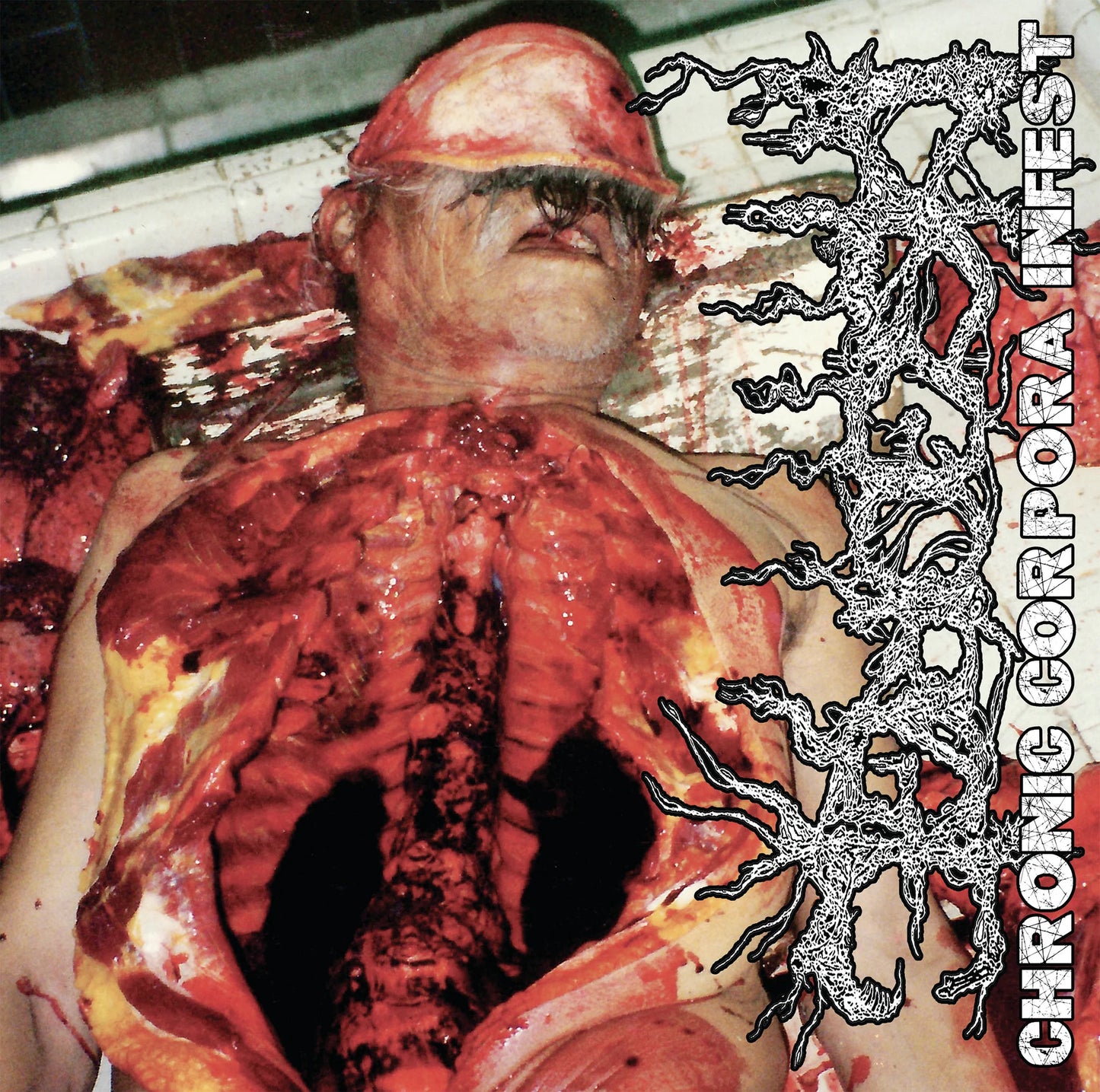 Disgorge - Chronic Corpora Infest LP