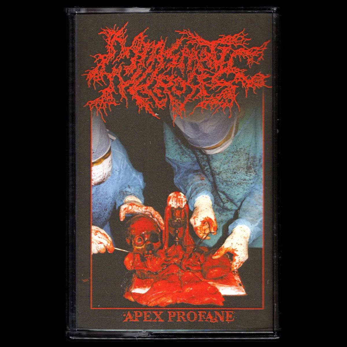 Miasmatic Necrosis - Apex Profane cassette tape