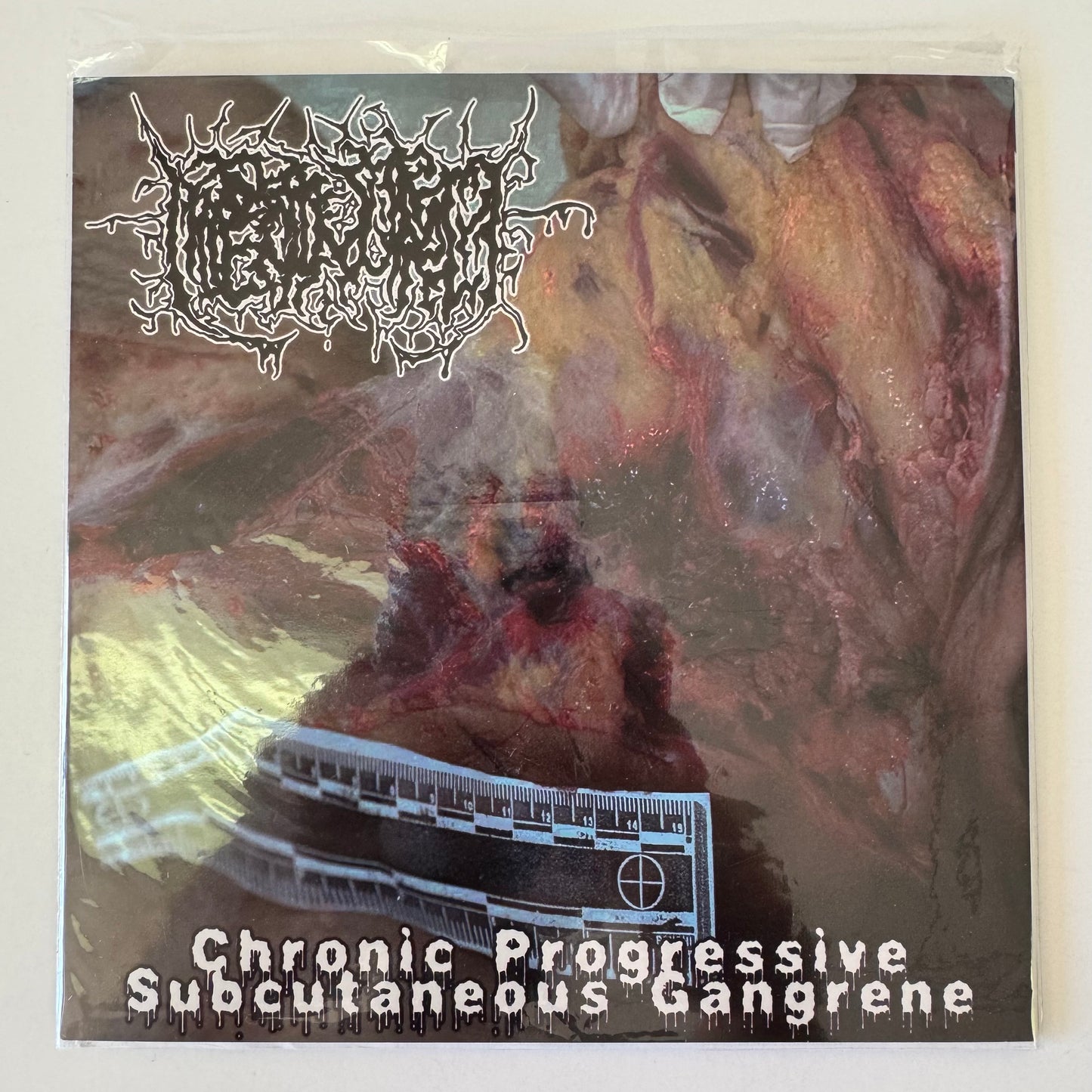 Hipermenorrea / Cannibe – Chronic Progressive Subcutaneous Gangrene / Laboratorio De Anatomia 7" EP (used)