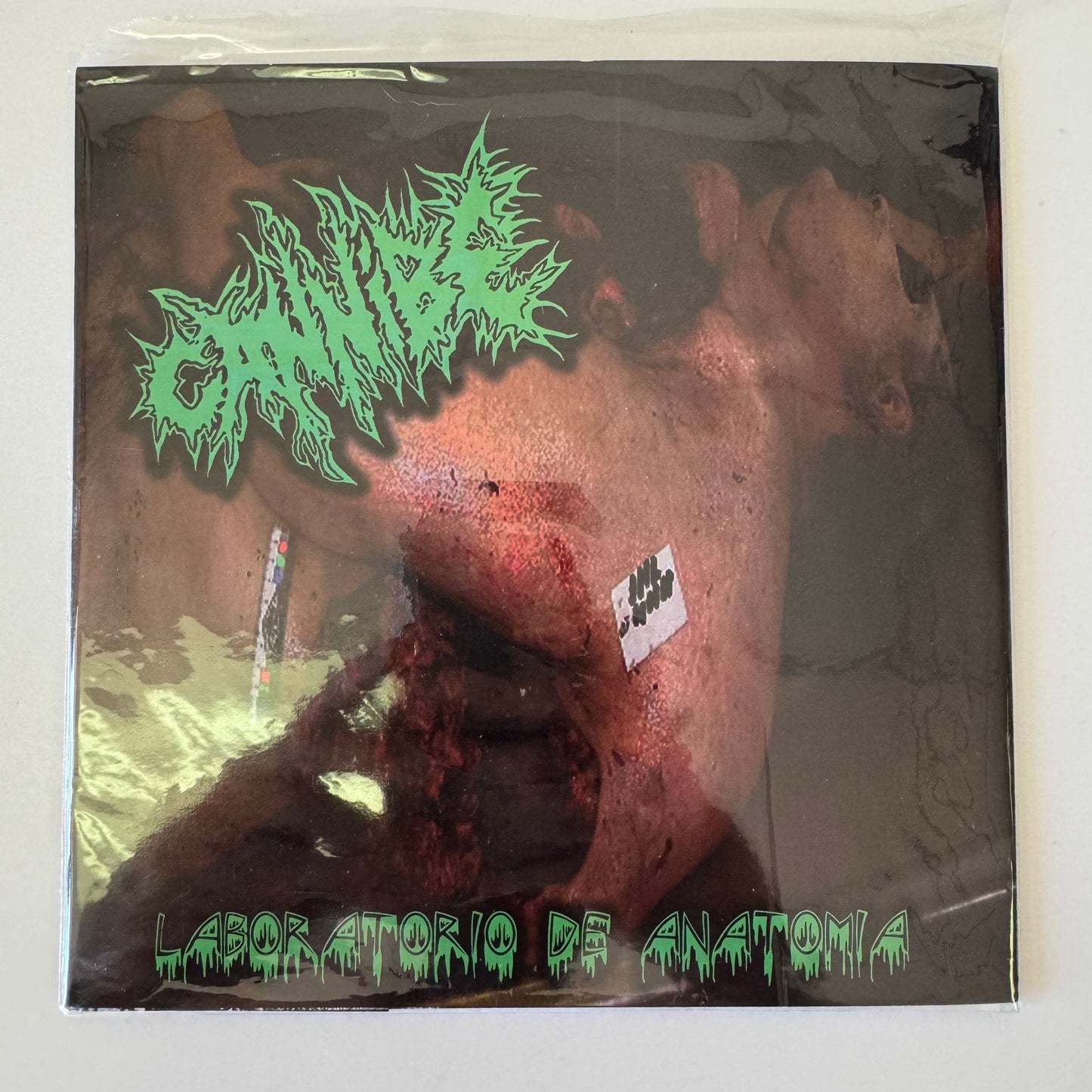 Hipermenorrea / Cannibe – Chronic Progressive Subcutaneous Gangrene / Laboratorio De Anatomia 7" EP (used)