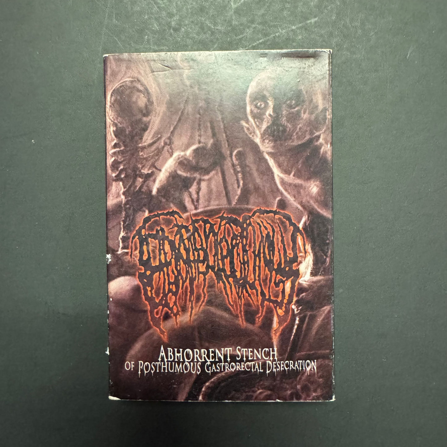 Epicardiectomy - Abhorrent Stench of Posthumous Gastrorectal Desecration cassette tape (used)